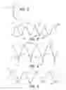 Fig. 03 - Bypass device, support frame for bypass device, and method