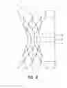 Fig. 06 - Bypass device, support frame for bypass device, and method