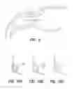 Fig. 07 - Bypass device, support frame for bypass device, and method