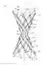 Fig. 01 - BYPASS DEVICE, SUPPORT FRAME FOR BYPASS DEVICE, AND METHOD