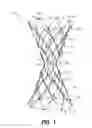 Fig. 02 - BYPASS DEVICE, SUPPORT FRAME FOR BYPASS DEVICE, AND METHOD