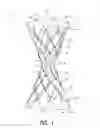 Fig. 02 - Bypass device, support frame for bypass device, and method