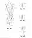 Fig. 04 - Bypass device, support frame for bypass device, and method
