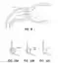 Fig. 07 - Bypass device, support frame for bypass device, and method