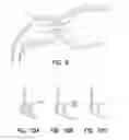 Fig. 07 - BYPASS DEVICE, SUPPORT FRAME FOR BYPASS DEVICE, AND METHOD