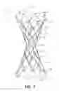 Fig. 02 - Bypass device, support frame for bypass device, and method