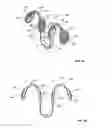 Fig. 07 - DEVICE FOR IMPROVING AIR FLOW THROUGH A NASAL CAVITY DURING PHYSICAL  ACTIVITY SUCH AS SPROTING PURSUITS