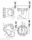 Fig. 05 - Non-invasive devices and methods for lowering intra-ocular pressure