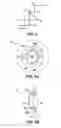 Fig. 03 - Method and apparatus for creating ocular surgical and relaxing incisions
