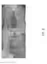 Fig. 03 - Negative pressure wound closure device