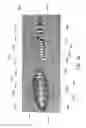 Fig. 32 - Negative pressure wound closure device