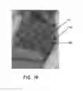 Fig. 33 - Negative pressure wound closure device