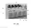 Fig. 35 - Negative pressure wound closure device