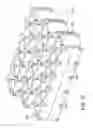 Fig. 70 - Negative pressure wound closure device