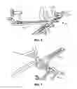 Fig. 06 - Lower extremity positioning assembly and table extension