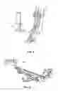 Fig. 07 - Lower extremity positioning assembly and table extension