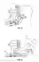 Fig. 09 - Lower extremity positioning assembly and table extension