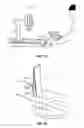Fig. 10 - Lower extremity positioning assembly and table extension