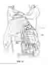 Fig. 13 - Lower extremity positioning assembly and table extension