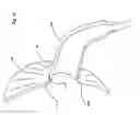 Fig. 13 - Hands free breast pump