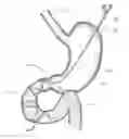 Fig. 01 - Device, kit and method for placing jejunal tube device through stomach and into small intestine related application