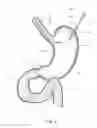 Fig. 03 - Device, kit and method for placing jejunal tube device through stomach and into small intestine related application