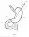 Fig. 06 - Device, kit and method for placing jejunal tube device through stomach and into small intestine related application