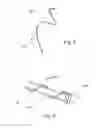 Fig. 09 - Device, kit and method for placing jejunal tube device through stomach and into small intestine related application