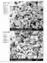 Fig. 14 - Dry powder formulations and methods for treating pulmonary diseases
