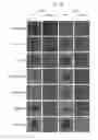 Fig. 02 - Method of treating microbial infections