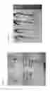 Fig. 04 - Composition comprising metformin as active ingredient for preventing or treating inflammatory bowel disease