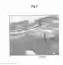 Fig. 03 - Composition and method for the protection of articular cartilage