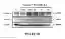 Fig. 10 - Process and composition for stabilization of vulnerable plaque utilizing a combination of a statin and omega 3 fatty acids