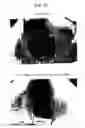 Fig. 16 - AGENT FOR APPLYING TO MUCOSA AND METHOD FOR THE PRODUCTION THEREOF