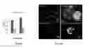 Fig. 32 - OXYGEN-CONTROLLABLE AND HYPOXIA-INDUCIBLE HYDROGELS
