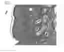 Fig. 03 - MODULATION OF ZINC LEVELS TO IMPROVE TISSUE PROPERTIES
