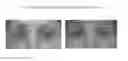 Fig. 14 - MODULATION OF ZINC LEVELS TO IMPROVE TISSUE PROPERTIES