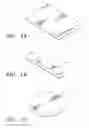 Fig. 02 - ECM Constructs for treating damaged biological tissue