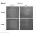 Fig. 11 - Methods for diagnosing, prognosing and treating muscular dystrophy