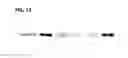 Fig. 12 - Methods for diagnosing, prognosing and treating muscular dystrophy