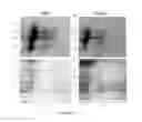 Fig. 02 - Immunogenic Compositions Of Staphylococcus Epidermidis Polypeptide Antigens