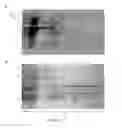 Fig. 03 - Immunogenic Compositions Of Staphylococcus Epidermidis Polypeptide Antigens