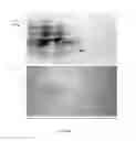 Fig. 05 - Immunogenic Compositions Of Staphylococcus Epidermidis Polypeptide Antigens