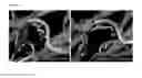 Fig. 18 - METHODS AND MEANS FOR THE PRODUCTION OF IG-LIKE MOLECULES