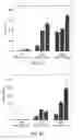 Fig. 04 - SYSTEM AND METHOD FOR USING ULTRASOUND-STIMULATED MICROBUBBLE EXPOSURES TO INDUCE CERAMIDE ACCUMULATION IN ENDOTHELIAL AND TUMOR CELLS