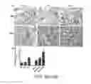 Fig. 25 - SYSTEM AND METHOD FOR USING ULTRASOUND-STIMULATED MICROBUBBLE EXPOSURES TO INDUCE CERAMIDE ACCUMULATION IN ENDOTHELIAL AND TUMOR CELLS