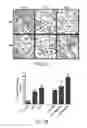 Fig. 27 - SYSTEM AND METHOD FOR USING ULTRASOUND-STIMULATED MICROBUBBLE EXPOSURES TO INDUCE CERAMIDE ACCUMULATION IN ENDOTHELIAL AND TUMOR CELLS
