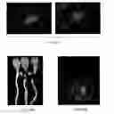Fig. 32 - COMPOSITIONS AND METHODS FOR TREATING DISEASES