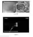 Fig. 33 - COMPOSITIONS AND METHODS FOR TREATING DISEASES