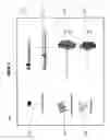 Fig. 05 - Multiphasic bone graft substitute material